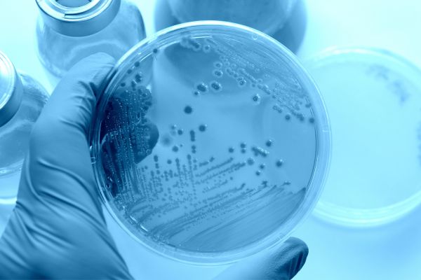 UHT Technology Eliminate Microorganisms (1)